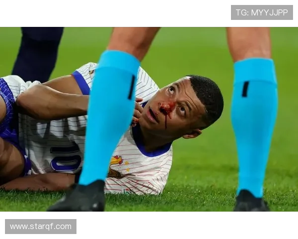 姆巴佩缺席法国训练两天今日将决定是否能参加比赛